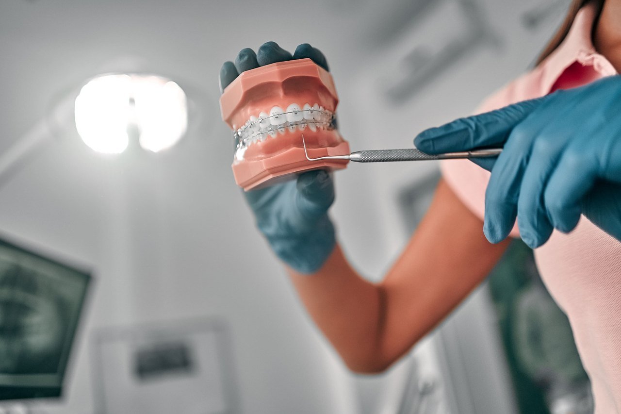 Airway orthodontics consultation at Breathing Wellness Orlando Provider pointing out bracket placement on a dental arch model fitted with braces