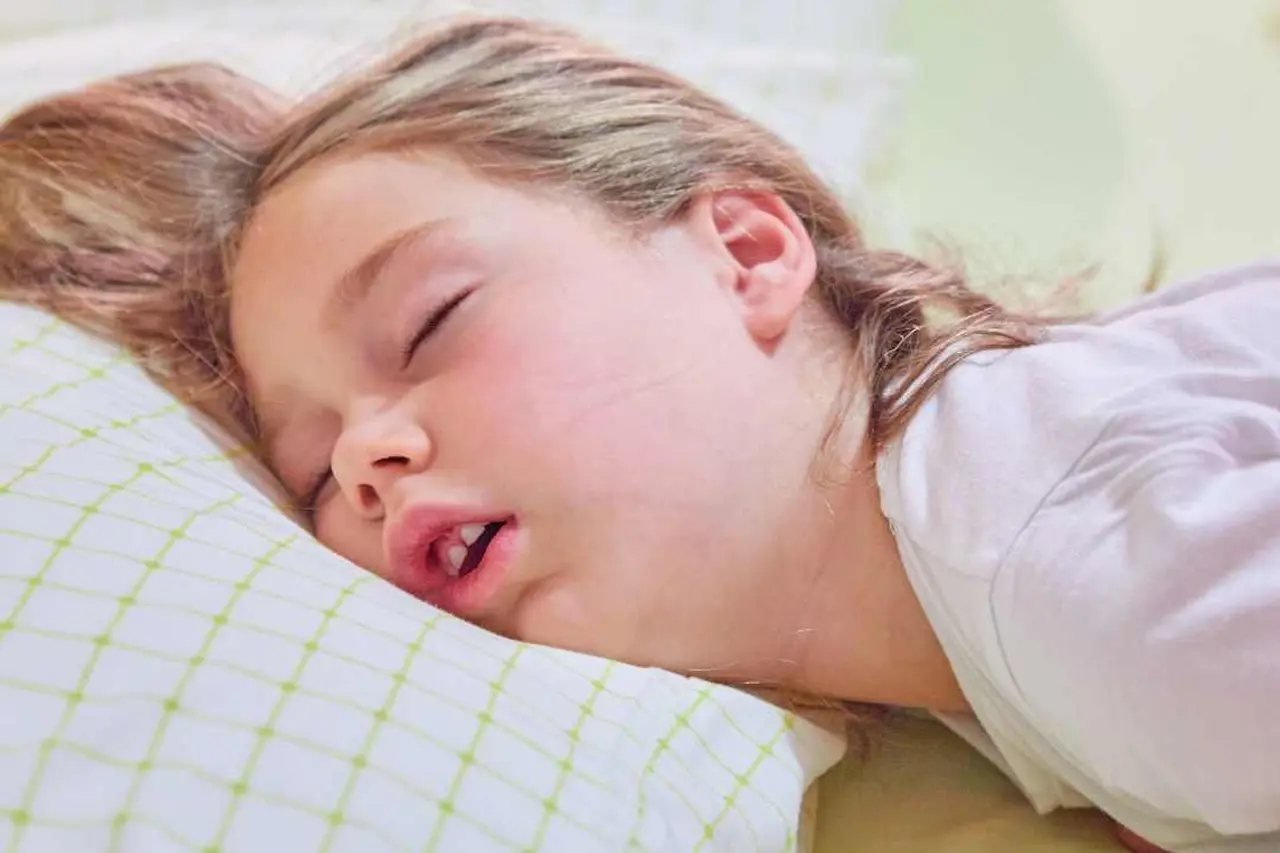 Signs of sleep apnea in children Young child sleeping with mouth open in bed, illustrating common nighttime signs of sleep apnea in kids