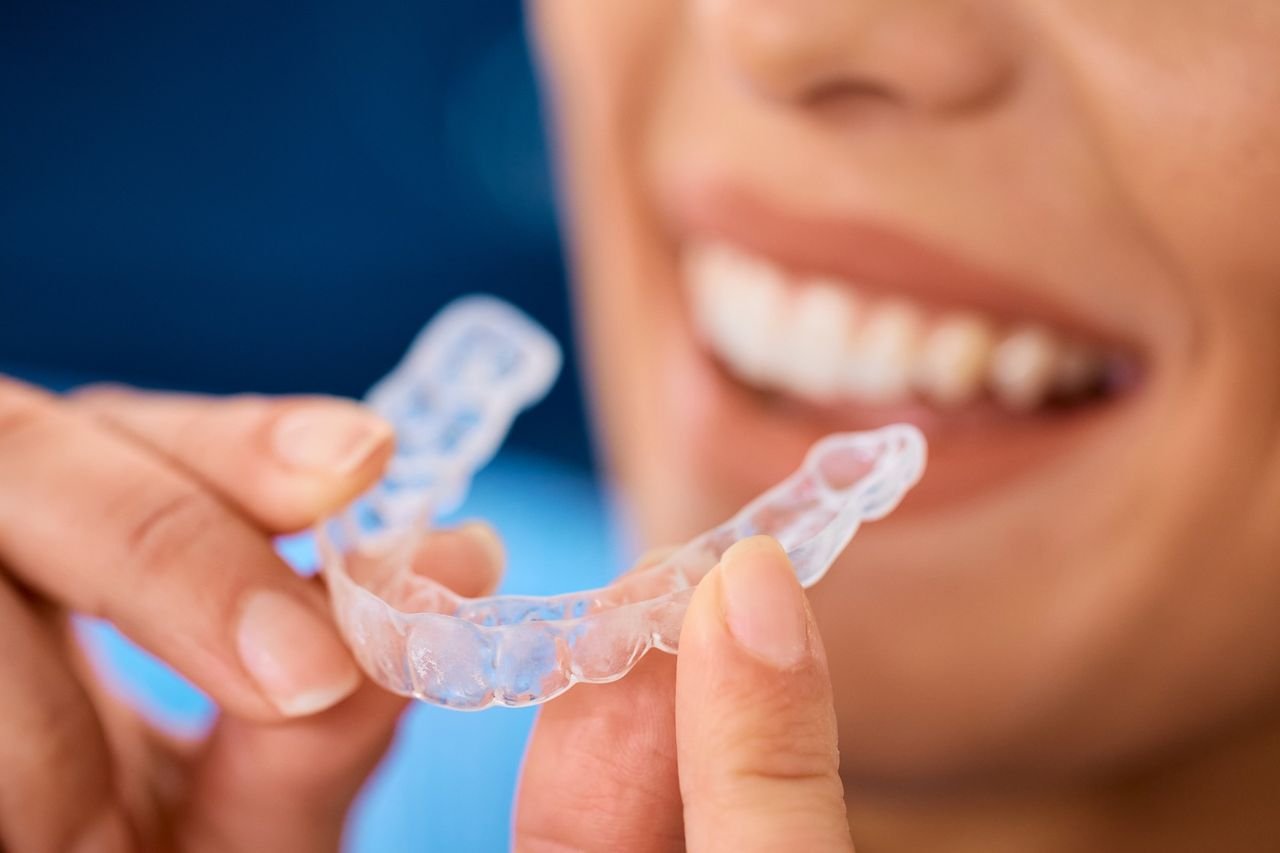 An underbite can involve the teeth, the jaws, or both Smiling patient holding a clear aligner