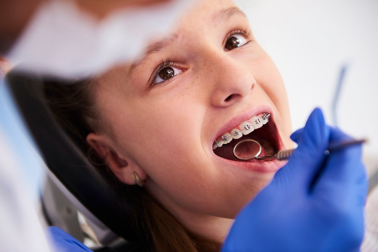 Options depend on whether the cause is dental, skeletal, or both Provider examining a girl's bite and braces during a dental exam