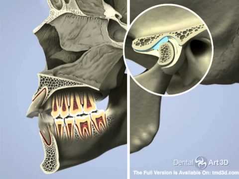 Video: the airway and TMJ connection Video thumbnail — how the airway is connected to TMJ and facial pain