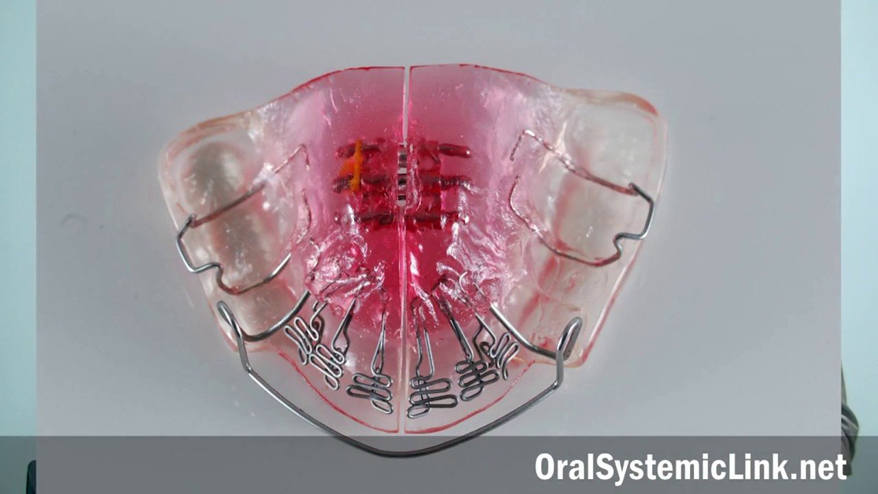 Video: Dr. David Singh on the DNA appliance Video thumbnail — Dr. David Singh discusses the DNA appliance for airway development